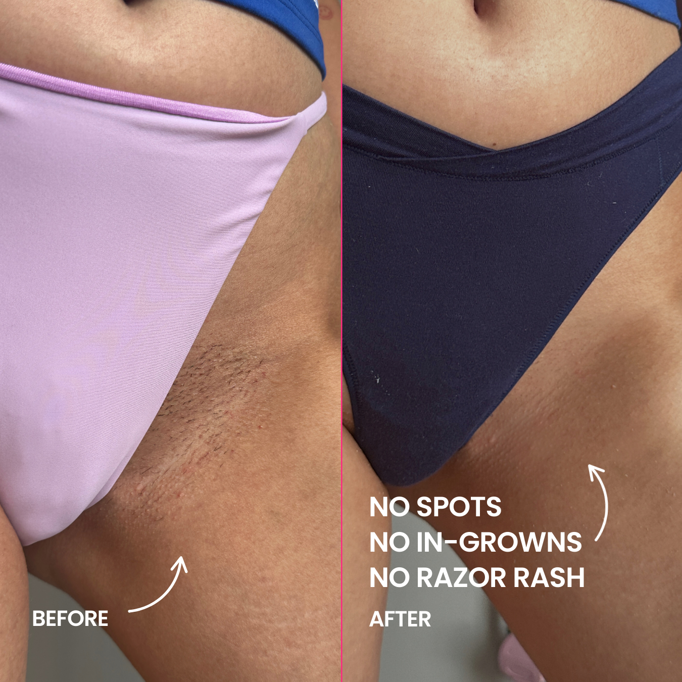 Tame it! Hair Removal Cream Dolphin Smooth Bundle